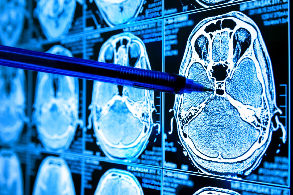 Artificial,Intelligence,In,Smart,Healthcare,Hospital,Technology,Concept Image description